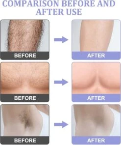 Livingful Premium Crystal Hair Removal • Pijnloos Ontharing Epileerapparaat Voor Armen Benen Rug• Mannen En Vrouwen • Epilator Voor Langdurige Ontharing • Snelle En Gemakkelijke Exfoliërende Ontharin • Haarverwijderaar • Kristalpad • Zijdezachte Huid 14 Livingful Premium Crystal Hair Removal • Pijnloos Ontharing Epileerapparaat Voor Armen Benen Rug• Mannen En Vrouwen • Epilator Voor Langdurige Ontharing • Snelle En Gemakkelijke Exfoliërende Ontharin • Haarverwijderaar • Kristalpad • Zijdezachte Huid -Gillette Winkel 1005x1200 5