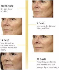 Gezicht Collageen | Lifting Verstevigende Serum | Rimpel Verwijderaar | Anti Aging Care - Retinol Firming -Gillette Winkel 1020x1200 1