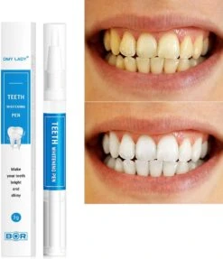 BOR Tanden Bleekpen - Tanden Bleken - Tandenbleekset - Whitening Pen - Tandenblekers - Wittere Tanden - Teeth Whitening Pen - Tanden Bleker 11 BOR Tanden Bleekpen - Tanden Bleken - Tandenbleekset - Whitening Pen - Tandenblekers - Wittere Tanden - Teeth Whitening Pen - Tanden Bleker -Gillette Winkel 1031x1200