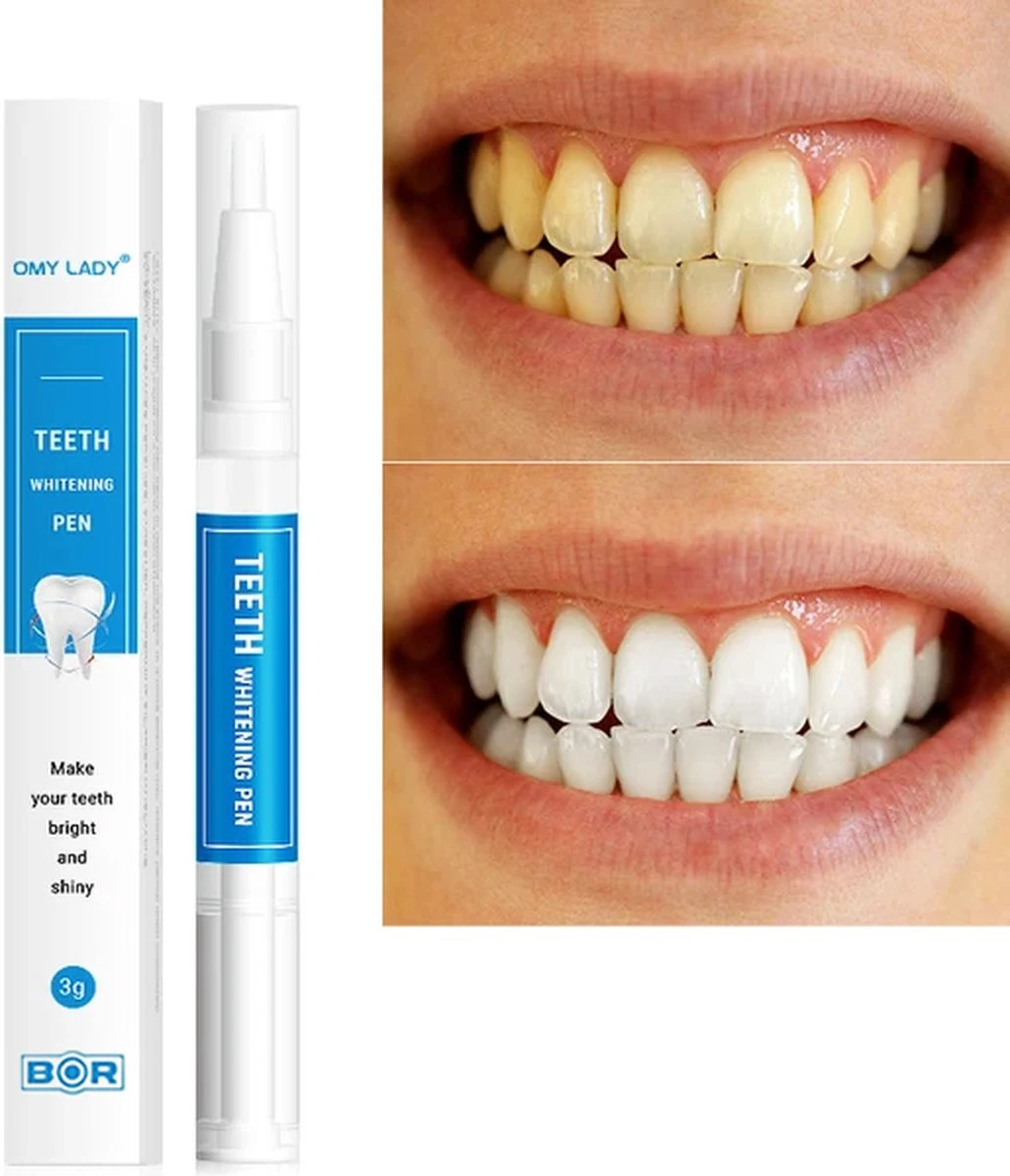 BOR Tanden Bleekpen - Tanden Bleken - Tandenbleekset - Whitening Pen - Tandenblekers - Wittere Tanden - Teeth Whitening Pen - Tanden Bleker 5 BOR Tanden Bleekpen - Tanden Bleken - Tandenbleekset - Whitening Pen - Tandenblekers - Wittere Tanden - Teeth Whitening Pen - Tanden Bleker - Afbeelding 3