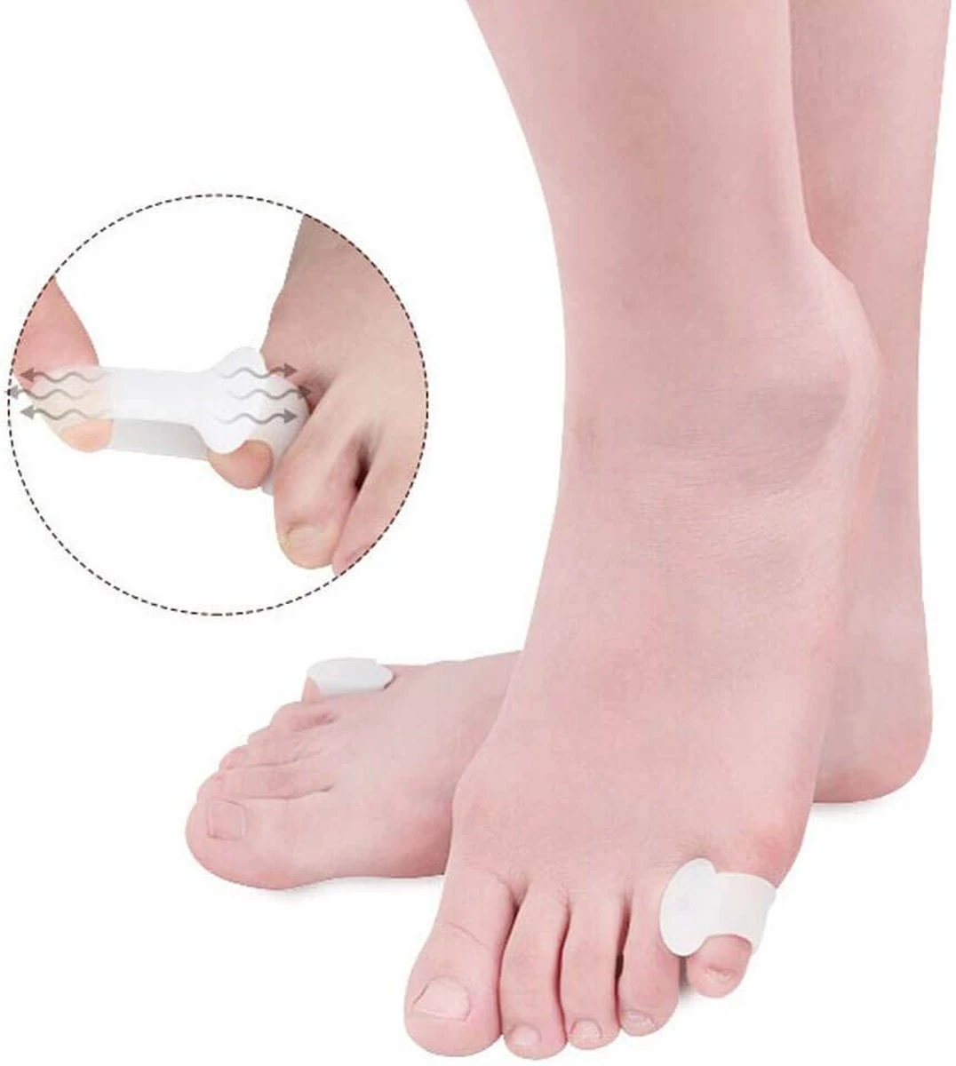 Solelution Kleine Teenspreider - Teencorrector - Per Paar 4 Solelution Kleine Teenspreider - Teencorrector - Per Paar - Afbeelding 2