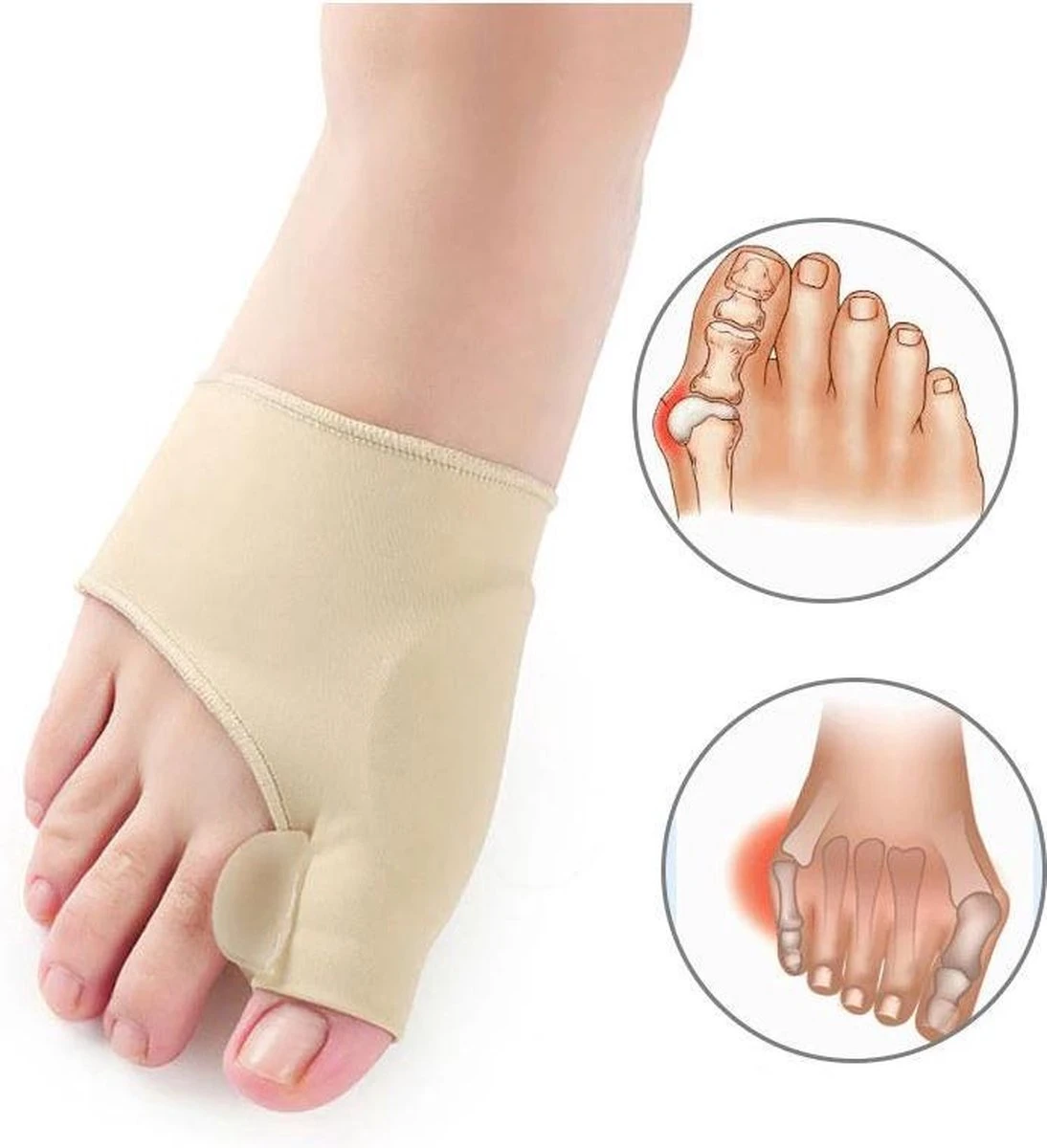 Hallux Valgus - Teenspreider - Teencorrector - Hallux Valgus Grote Teencorrector - Sok 2 Stuks 6 Hallux Valgus - Teenspreider - Teencorrector - Hallux Valgus Grote Teencorrector - Sok 2 Stuks - Afbeelding 4