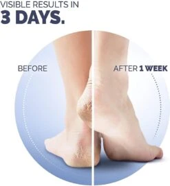 Scholl Klovenzalf - K+ Creme - Voor Hielkloven En Ruwe, Droge Huid 15 Scholl Klovenzalf - K+ Creme - Voor Hielkloven En Ruwe, Droge Huid -Gillette Winkel 1094x1200 8