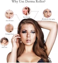 Dermaroller 0.5 Mm & Desinfectie Alcohol Spray - 540 Naalden - Steriel Verpakt -Gillette Winkel 1111x1200 7