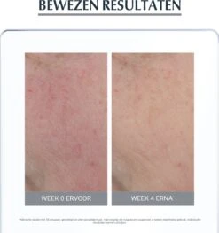 Eucerin Anti-redness Kalmerend - Dagcrème - 50 Ml 17 Eucerin Anti-redness Kalmerend - Dagcrème - 50 Ml -Gillette Winkel 1125x1200 2