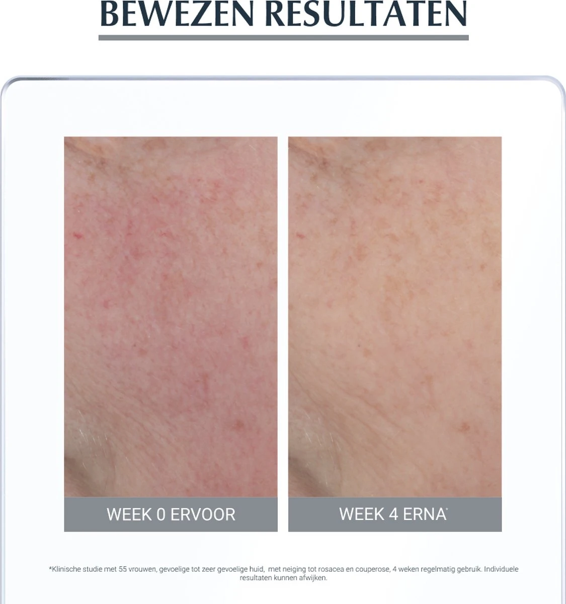 Eucerin Anti-redness Kalmerend - Dagcrème - 50 Ml 8 Eucerin Anti-redness Kalmerend - Dagcrème - 50 Ml - Afbeelding 6