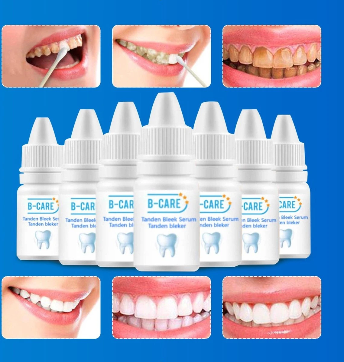 B-care Tanden Bleker – Wittere Tanden – Teeth Whitening Strips – Professioneel Resultaat - Tandsteen Verwijderaar - Zonder Peroxide - Tandenbleekset - Tanden Bleken 11 B-care Tanden Bleker – Wittere Tanden – Teeth Whitening Strips – Professioneel Resultaat - Tandsteen Verwijderaar - Zonder Peroxide - Tandenbleekset - Tanden Bleken - Afbeelding 9