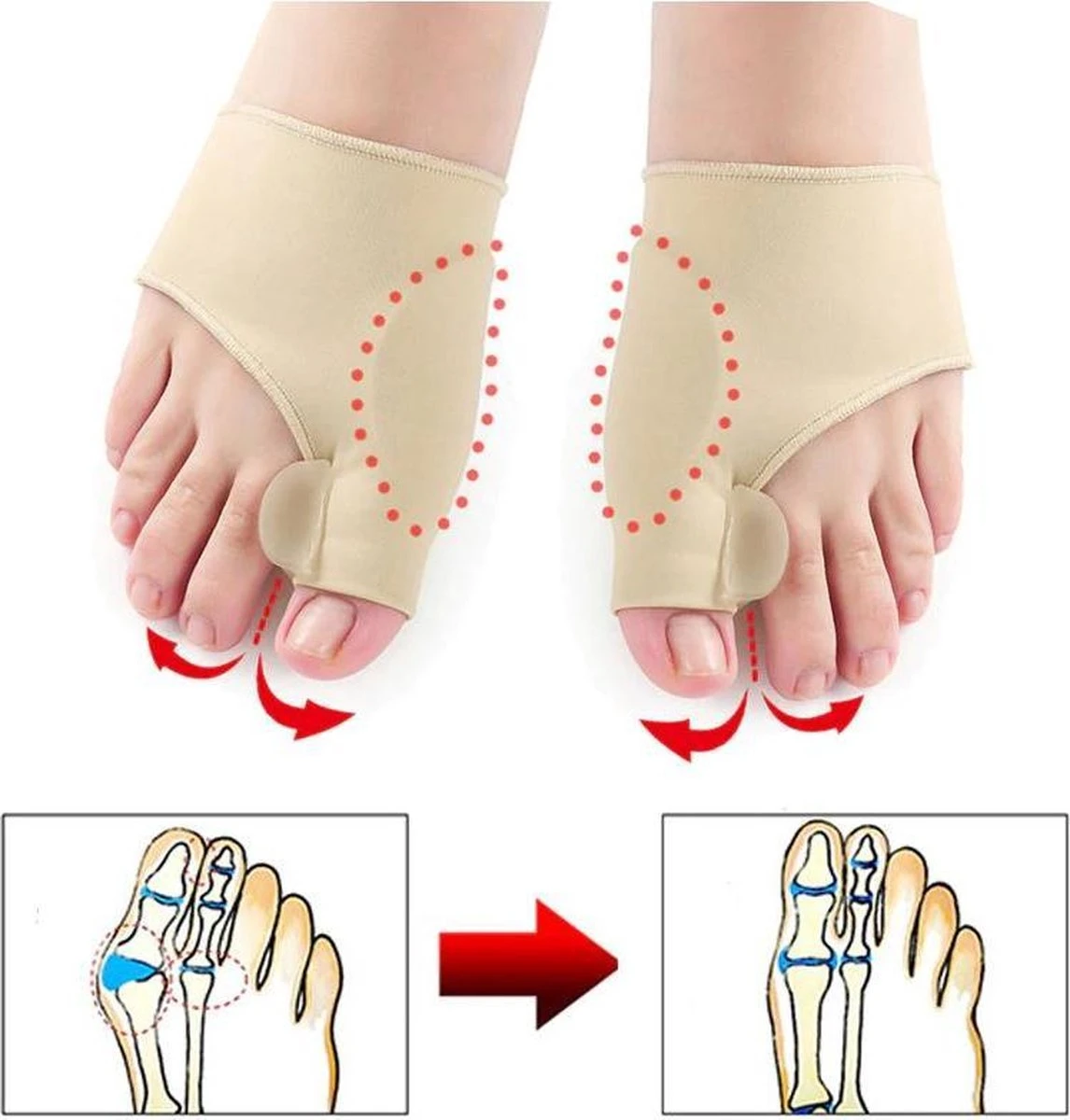 Hallux Valgus - Teenspreider - Teencorrector - Hallux Valgus Grote Teencorrector - Sok 2 Stuks 3 Hallux Valgus - Teenspreider - Teencorrector - Hallux Valgus Grote Teencorrector - Sok 2 Stuks