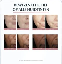 Eucerin Anti-Pigment Serum Duo - Serum - 30 Ml - Voor Alle Huidtypen -Gillette Winkel 1157x1200 4