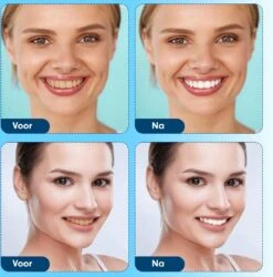 Diamond White - Teeth Whitening Strips - 28x Strips - Zonder Peroxide (0%) - Tandenbleekset - Tandenbleek Strips – Mint -Gillette Winkel 1185x1200