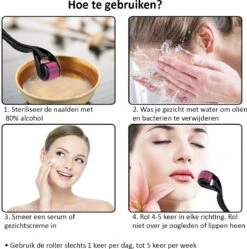 Dermaroller - 540 Naalden - Dermaroller Haargroei - Huidverzorging -Gillette Winkel 1190x1200 7