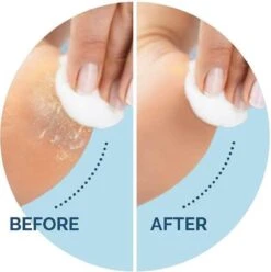 Scholl Velvet Smooth Voetvijl Wet & Dry - Starter - 1 Stuk -Gillette Winkel 1196x1200 26