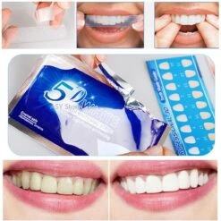 Tanden Bleken Strips | Tanden Bleken | Tanden Strips | Wit Gebit | Witte Tanden | Tandenblekers | Tandenbleekset | Teeth Whitening Strips | Tandenbleek Strips | Geen Crest | Crest Whitestrips | Wittere Tanden | 5D White | 28 Stuks (14zakjes) -Gillette Winkel 1198x1200