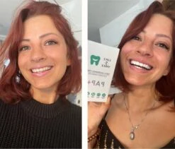 Love2smile PAP+ Premium Strips - Whitening Strips - De Natuurlijke Tandenbleker Van Nederland & België - Goedgekeurde Tandenbleek Strips - Teeth Whitening Strips - Wittere Tanden - Zonder Peroxide 11 Love2smile PAP+ Premium Strips - Whitening Strips - De Natuurlijke Tandenbleker Van Nederland & België - Goedgekeurde Tandenbleek Strips - Teeth Whitening Strips - Wittere Tanden - Zonder Peroxide -Gillette Winkel 1200x1023