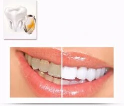 Merkloos Tanden Whitener Pen - Professionele Tandenbleek Gel - Tandenbleker -Gillette Winkel 1200x1026