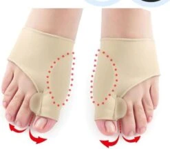 Merkloos Hallux Valgus Teen Spreider/Corrector Knobbel Teen Corrector |bunion | Eeltknobbel | Teen Rechtzetten | Comfortabel -Gillette Winkel 1200x1049 4