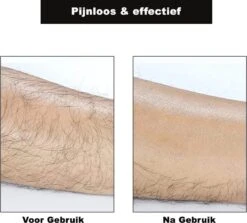 Crystal Hair Removal - Crystal Hair Eraser - Bleame - Kristalpad - Ontharing - Pijnloos - TikTok - Crystal Hair Remover - Haarverwijderaar -Gillette Winkel 1200x1082 11