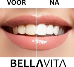 BELLAVITA Tandenbleekset - Tanden Bleken - Teeth Whitening Kit - Tandenblekers - 4 Gelpennen - Zonder Peroxide - 100% Natuurlijk - Witte Tanden -Gillette Winkel 1200x1095 1