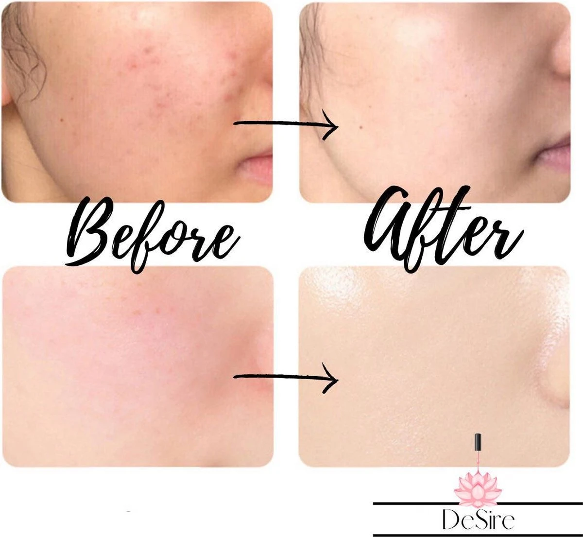 Derma Roller - 540 Needle - 0.5 MM Naald - Steriel Verpakt - Skin Roller - Huid Verzorging - Huidverzorging - Dermaroller - Baardgroei Stimuleren - HaarGroei Stimulatie - Haar En Huid - Strakke Huid - Acné - Puisten - Striae - Littekens 9 Derma Roller - 540 Needle - 0.5 MM Naald - Steriel Verpakt - Skin Roller - Huid Verzorging - Huidverzorging - Dermaroller - Baardgroei Stimuleren - HaarGroei Stimulatie - Haar En Huid - Strakke Huid - Acné - Puisten - Striae - Littekens - Afbeelding 7