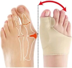 Hallux Valgus - Teenspreider - Teencorrector - Hallux Valgus Grote Teencorrector - Sok 2 Stuks 11 Hallux Valgus - Teenspreider - Teencorrector - Hallux Valgus Grote Teencorrector - Sok 2 Stuks -Gillette Winkel 1200x1133 6