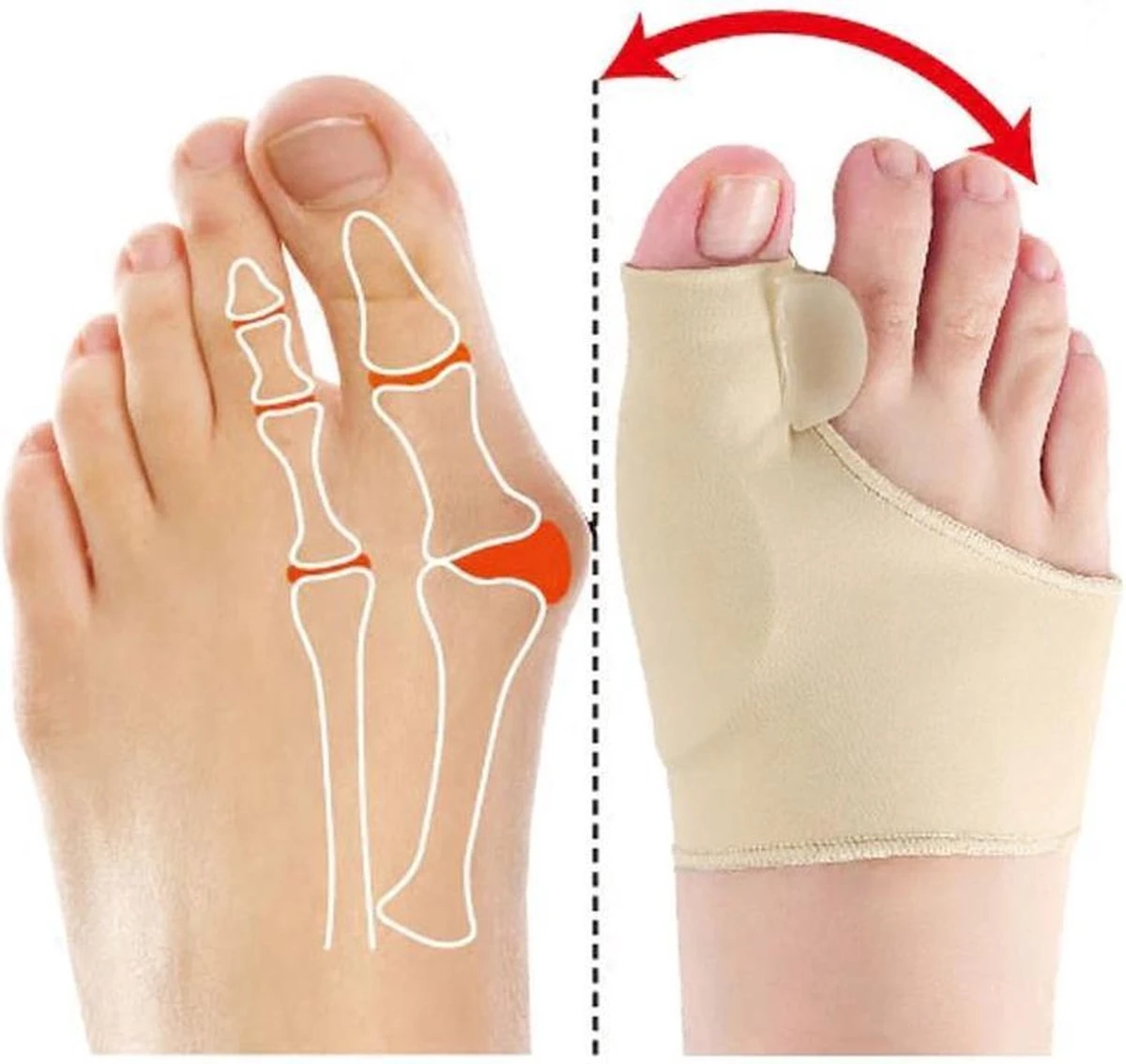 Hallux Valgus - Teenspreider - Teencorrector - Hallux Valgus Grote Teencorrector - Sok 2 Stuks 5 Hallux Valgus - Teenspreider - Teencorrector - Hallux Valgus Grote Teencorrector - Sok 2 Stuks - Afbeelding 3