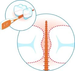 Tepe EasyPick Paars Maat XL – 36 Stuks -Gillette Winkel 1200x1146 1