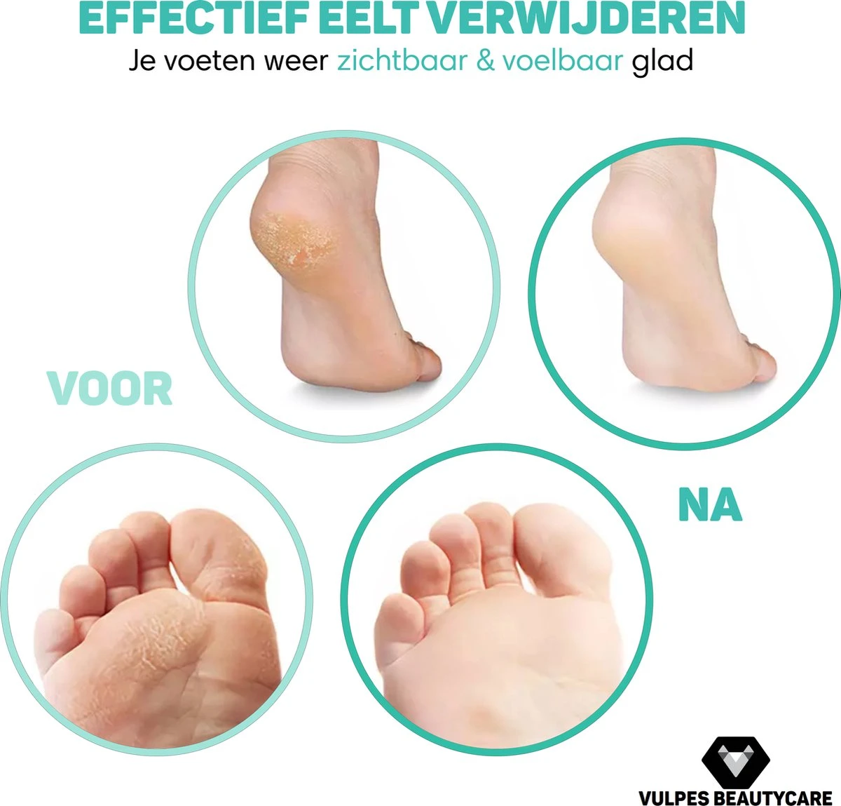 Vulpes BeautyCare® Elektrische Eelt Verwijderaar Pro – Stofzuigfunctie – 3 Snelheden – Inclusief 3 Vijlschijven & Borstel - USB-Oplaadbaar 4 Vulpes BeautyCare® Elektrische Eelt Verwijderaar Pro – Stofzuigfunctie – 3 Snelheden – Inclusief 3 Vijlschijven & Borstel - USB-Oplaadbaar - Afbeelding 2