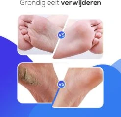 LifeWise Elektrische Eelt Verwijderaar - Voetvijl - 60 Vervangbare Schuurpads - Netstroom Adapter -Gillette Winkel 1200x1155 10