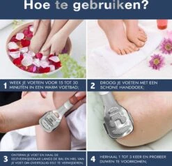 Pedicureset Professioneel - Pedicure Eeltmesjes - Eelt Verwijderaar Pedicure Set - Eeltverwijderaar Voetvijl - Eeltschraper - Eeltschaaf - Eeltrasp 18 Pedicureset Professioneel - Pedicure Eeltmesjes - Eelt Verwijderaar Pedicure Set - Eeltverwijderaar Voetvijl - Eeltschraper - Eeltschaaf - Eeltrasp -Gillette Winkel 1200x1157 13