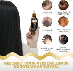 BeautyFit - Haargroei Serum - Haargroei Versneller - Inclusief Scalp Massager En Ebook - Haargroei Producten Mannen Vrouwen - Biotine - Haar Versneller - Beschadigd Haar - Haar Vitamines 13 BeautyFit - Haargroei Serum - Haargroei Versneller - Inclusief Scalp Massager En Ebook - Haargroei Producten Mannen Vrouwen - Biotine - Haar Versneller - Beschadigd Haar - Haar Vitamines -Gillette Winkel 1200x1163 6