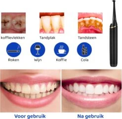 ExCorn Elektrische Tandsteen Verwijderaar - Inclusief 6-delig Tandartsset - 3 Standen - Elektrisch Tandplak Verwijderen - Tanden Polijsten -Gillette Winkel 1200x1173 4