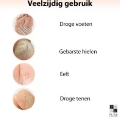 PureLuxure Voetmasker - Voetverzorging - Eeltsokken - Eelt Verwijderaar - Voetenmasker - Peel Off Masker - 1 Paar (2 Stuks) -Gillette Winkel 1200x1174 6