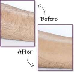 EPC® Duo Crystal Hair Removal Pad - Ontharings Pad - Pijnloos Ontharen - Kristal Haarverwijderaar - Scrubi - Ontharing Eraser Kristalpad - Bleame - Armen Benen Bikinilijn - Roze 9 EPC® Duo Crystal Hair Removal Pad - Ontharings Pad - Pijnloos Ontharen - Kristal Haarverwijderaar - Scrubi - Ontharing Eraser Kristalpad - Bleame - Armen Benen Bikinilijn - Roze -Gillette Winkel 1200x1177 10