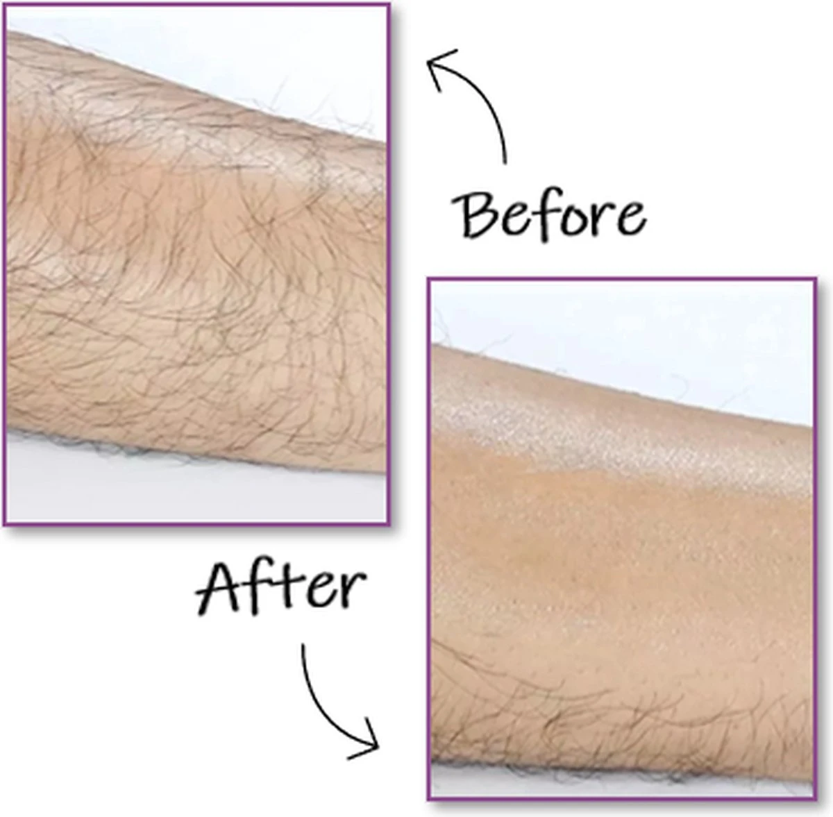 EPC® Duo Crystal Hair Removal Pad - Ontharings Pad - Pijnloos Ontharen - Kristal Haarverwijderaar - Scrubi - Ontharing Eraser Kristalpad - Bleame - Armen Benen Bikinilijn - Roze 6 EPC® Duo Crystal Hair Removal Pad - Ontharings Pad - Pijnloos Ontharen - Kristal Haarverwijderaar - Scrubi - Ontharing Eraser Kristalpad - Bleame - Armen Benen Bikinilijn - Roze - Afbeelding 4