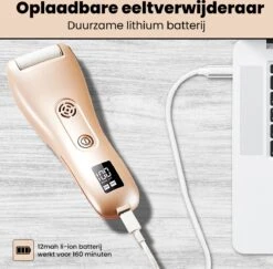 BAESS Elektrische Eeltverwijderaar - 3 Slijprollen - Afzuiging - Oplaadbaar - Goud -Gillette Winkel 1200x1179 18