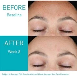 CeraVe Resurfacing Retinol Serum Tegen Restlittekentjes En Zichtbare Poriën, Voor Onzuivere Huid Met Neiging Tot Acne - 30 Ml -Gillette Winkel 1200x1188 5