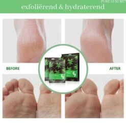 PureLuxure Voetmasker - Voetverzorging - Eeltsokken - Eelt Verwijderaar - Voetenmasker - Peel Off Masker - 1 Paar (2 Stuks) -Gillette Winkel 1200x1191 15