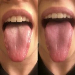 Orabrush Tongreiniger 11 Orabrush Tongreiniger -Gillette Winkel 1200x1197 7