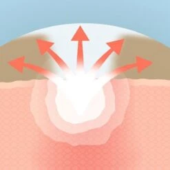 COSRX Acne Pimple Master 35 COSRX Acne Pimple Master -Gillette Winkel 1200x1200 1065