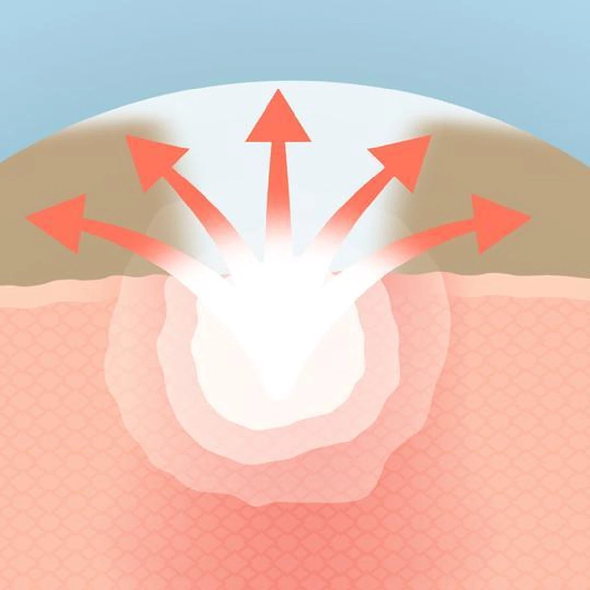 COSRX Acne Pimple Master 18 COSRX Acne Pimple Master - Afbeelding 16