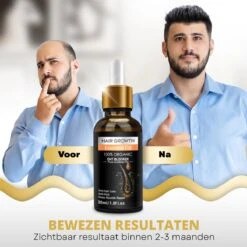BeautyFit - Haargroei Serum - Haargroei Versneller - Inclusief Scalp Massager En Ebook - Haargroei Producten Mannen Vrouwen - Biotine - Haar Versneller - Beschadigd Haar - Haar Vitamines 18 BeautyFit - Haargroei Serum - Haargroei Versneller - Inclusief Scalp Massager En Ebook - Haargroei Producten Mannen Vrouwen - Biotine - Haar Versneller - Beschadigd Haar - Haar Vitamines -Gillette Winkel 1200x1200 1244