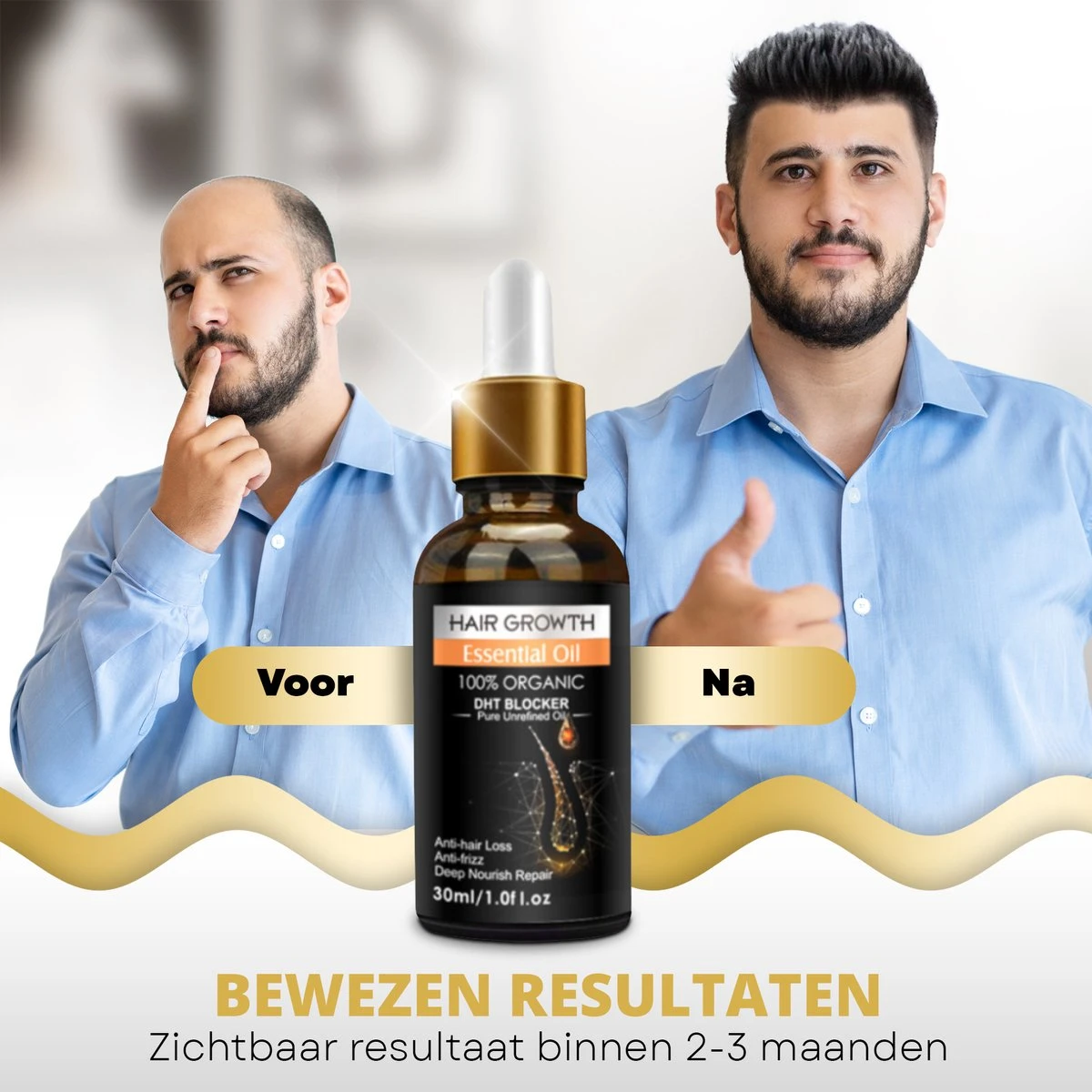 BeautyFit - Haargroei Serum - Haargroei Versneller - Inclusief Scalp Massager En Ebook - Haargroei Producten Mannen Vrouwen - Biotine - Haar Versneller - Beschadigd Haar - Haar Vitamines 10 BeautyFit - Haargroei Serum - Haargroei Versneller - Inclusief Scalp Massager En Ebook - Haargroei Producten Mannen Vrouwen - Biotine - Haar Versneller - Beschadigd Haar - Haar Vitamines - Afbeelding 8