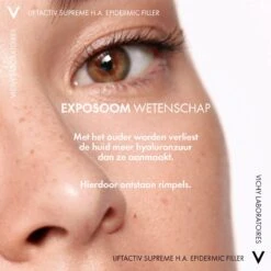 Vichy Liftactiv Supreme H.A. Epidermic Filler Serum - 30ml - Tegen Rimpels En Fijne Lijntjes, Ook Voor Gevoelige Huid 15 Vichy Liftactiv Supreme H.A. Epidermic Filler Serum - 30ml - Tegen Rimpels En Fijne Lijntjes, Ook Voor Gevoelige Huid -Gillette Winkel 1200x1200 1247