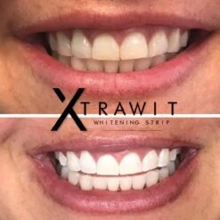 Xtrawit - Teeth Whitening Strips - Tandenbleekset - Wittere Tanden - Goedgekeurde Tandenbleek Strips - 30 Strips -Gillette Winkel 1200x1200 13