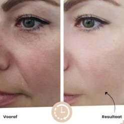 Vitamine C Serum Van Vicius® - Gezichtsverzorging Met Hyaluronzuur - Acne - Serum Gezicht - Anti Aging - 30ML -Gillette Winkel 1200x1200 1347