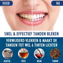 Southland Tandenbleekset - Tandenblekers - Whitening Strips - Teeth Whitening - Tanden Bleken -Gillette Winkel 1200x1200 137