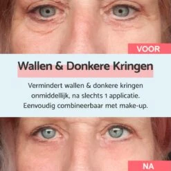 Remescar Wallen En Donkere Kringen 8ml - Crème Voor Wallen - Donkere Kringen Verwijderaar - Verwijdert Wallen Onder De Ogen - Onmiddellijke Wallen Behandeling - 180 Applicaties 13 Remescar Wallen En Donkere Kringen 8ml - Crème Voor Wallen - Donkere Kringen Verwijderaar - Verwijdert Wallen Onder De Ogen - Onmiddellijke Wallen Behandeling - 180 Applicaties -Gillette Winkel 1200x1200 1398