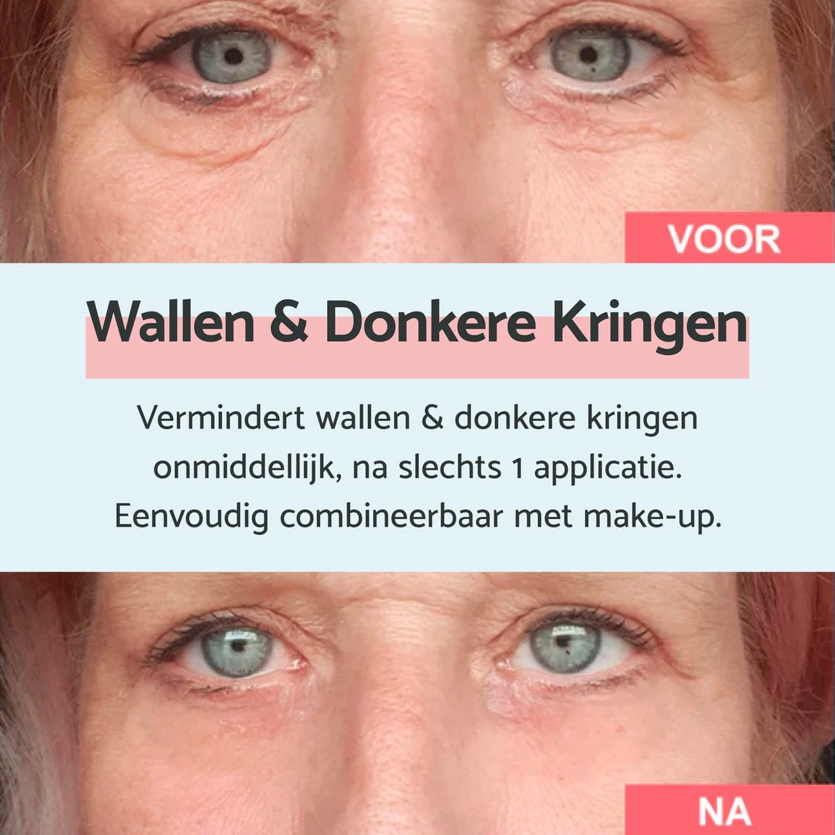 Remescar Wallen En Donkere Kringen 8ml - Crème Voor Wallen - Donkere Kringen Verwijderaar - Verwijdert Wallen Onder De Ogen - Onmiddellijke Wallen Behandeling - 180 Applicaties 8 Remescar Wallen En Donkere Kringen 8ml - Crème Voor Wallen - Donkere Kringen Verwijderaar - Verwijdert Wallen Onder De Ogen - Onmiddellijke Wallen Behandeling - 180 Applicaties - Afbeelding 6