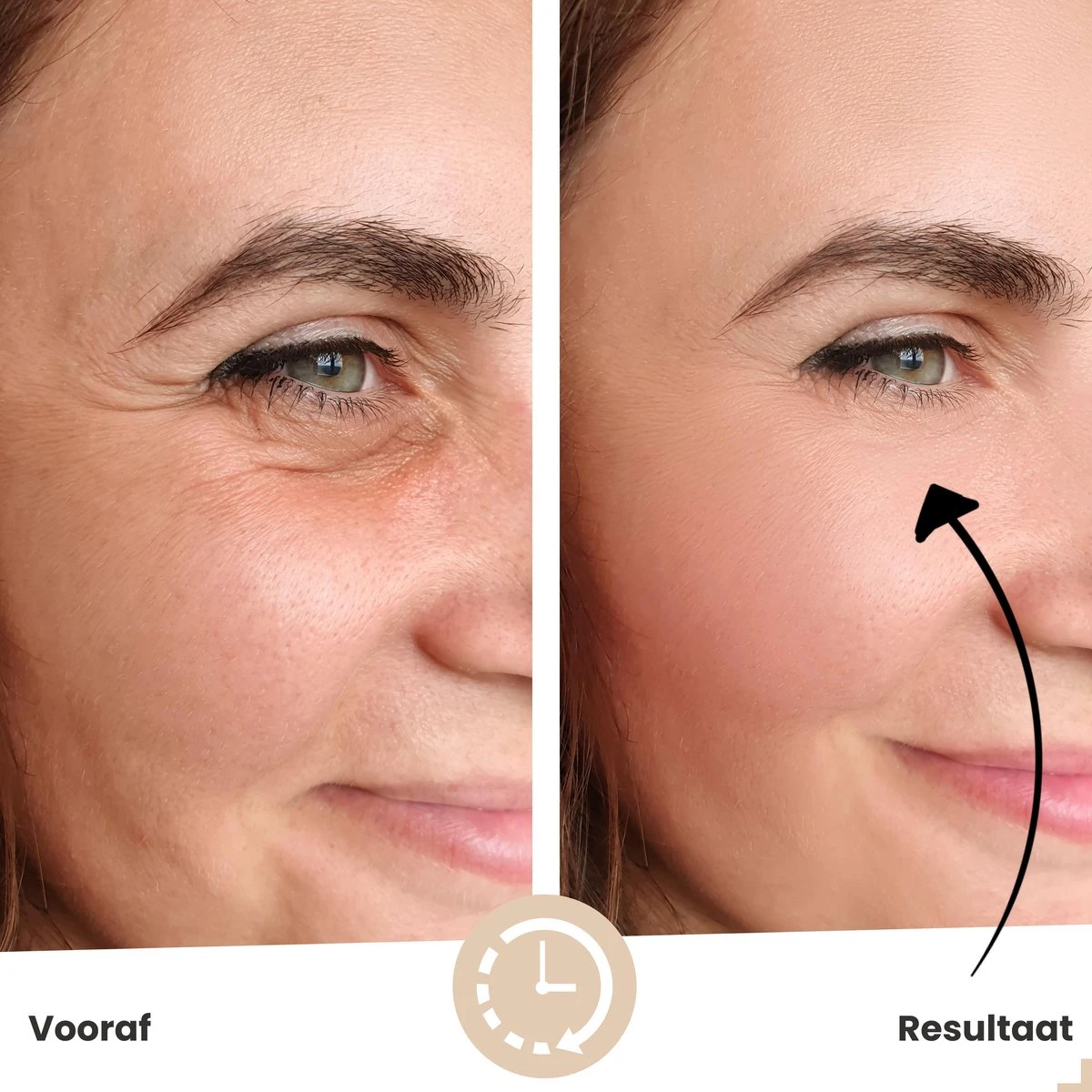 Collageen Oogmasker Van Vicius® - Gezichtsverzorging Tegen Wallen (10 Sets) - Eye Pads Tegen Donkere Kringen - Hydrogel 24K Goud 4 Collageen Oogmasker Van Vicius® - Gezichtsverzorging Tegen Wallen (10 Sets) - Eye Pads Tegen Donkere Kringen - Hydrogel 24K Goud - Afbeelding 2