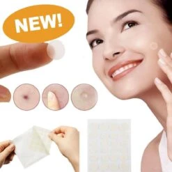Merkloos Pimple Patch - Acne Patch - Puisten Patch - Acne Sticker - Puisten Pleister - Pimple Patches - Acne Pleister - Puisten Verwijderaar - Puisten Creme - Acne Verwijderen Set - Acneverzorging | 36 Stuks & Directe Levering